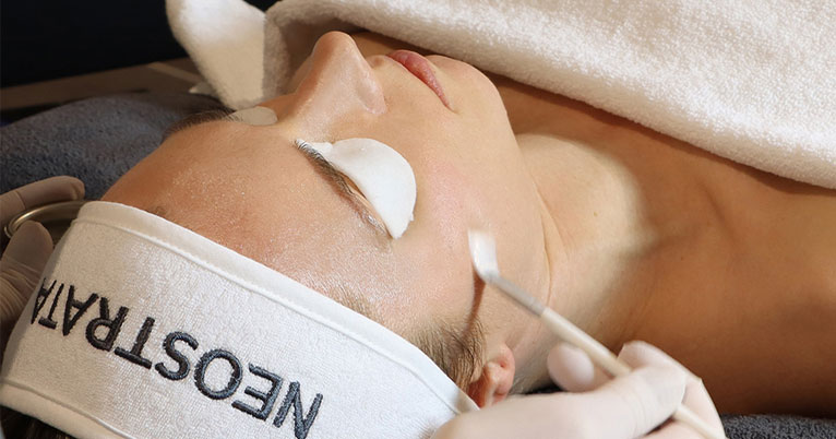 kemisk peeling behandling